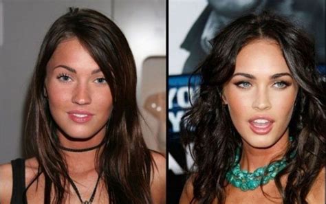 relatively shocking photos of celebrities before and after plastic surgery