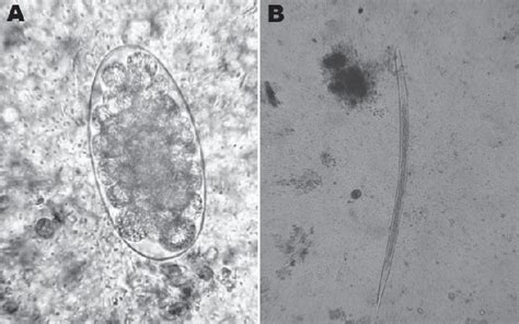 Figure Trichostrongylus Colubriformis Nematode Isolated From Feces Of