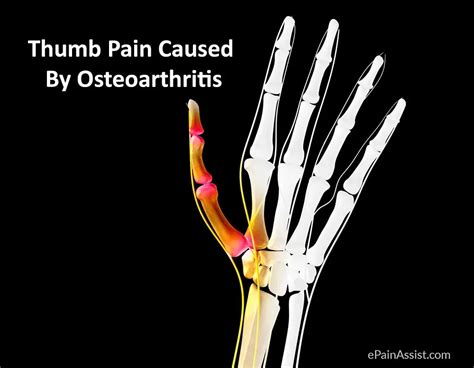 Elbow Wrist And Thumb Pain