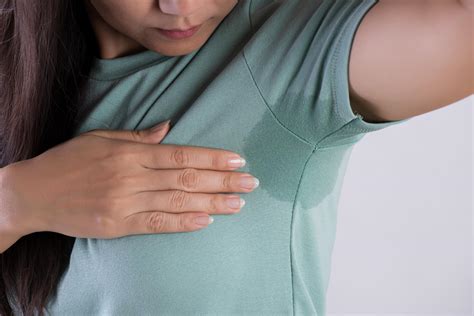 Hyperhidrosis What It Is Why It Happens And How Its Treated