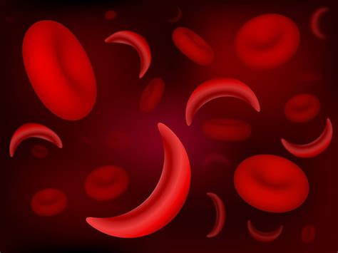 Bohrnsen Biology Blog Stem Cells And Sickle Cell Anmeia