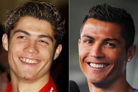 Christiano Ronaldo Before Plastic Surgery