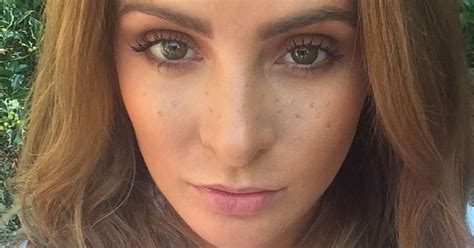 What Are Freckles Everything You Need To Know Including How To Fake