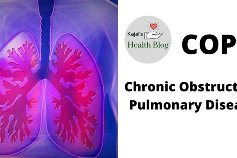 Copd Chronic Obstructive Pulmonary Disease Kajals Health Blog