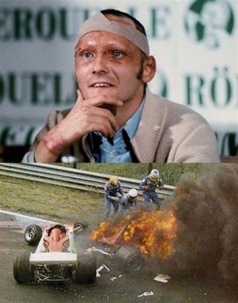 Niki Lauda Former Formula One Racer In The 1976 German Grand Prix His Car Exploded And He