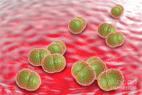 Meningitis Bacteria Infection Photograph By Ezume Images