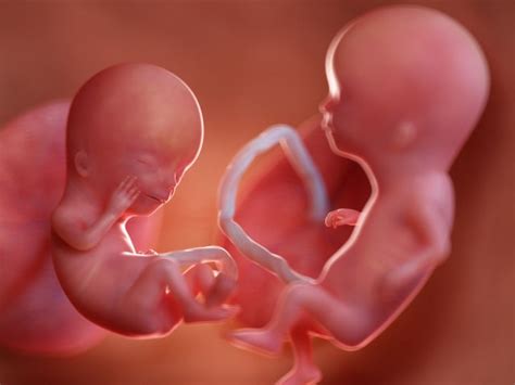 Foto Perkembangan Bayi Kembar Di Dalam Rahim Ibu Hamil