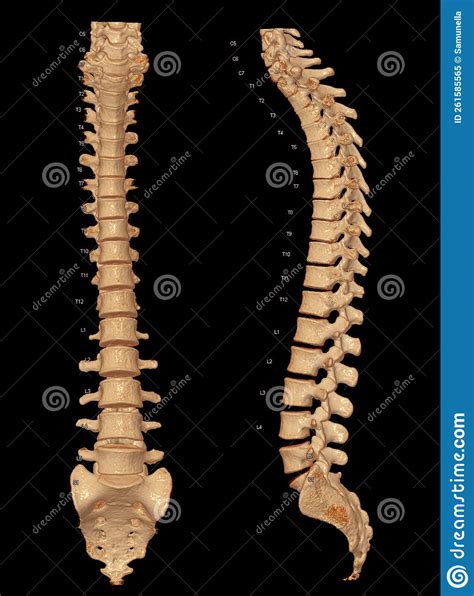 Ct Scan Of Whole Spine 3d Rendering Showing Profile Human Spine Stock