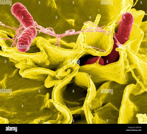 Scanning Electron Micrograph Sem Of Salmonella Typhimurium Red A