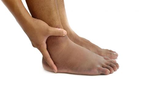What Are The Most Common Causes Of Foot Swelling