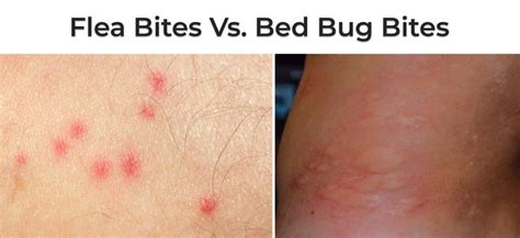 Difference Between A Flea Bite And A Bed Bug Bite Bed Western