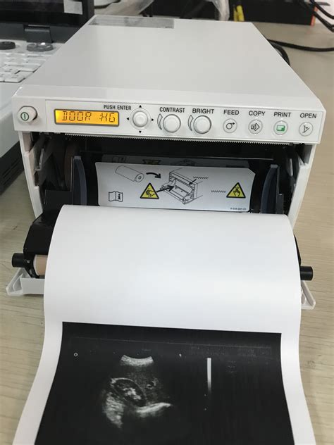 Original Sony Thermal Ultrasound Printer For Clinic Buy Sony