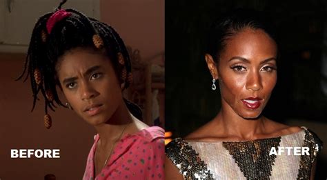 Jada Pinkett Smith Before And After Plastic Surgery Plastic Surgery Facts