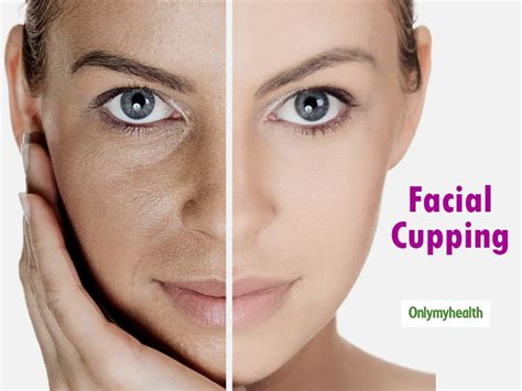 The Facial Cupping Expert The Home Of Facial Cupping Ar