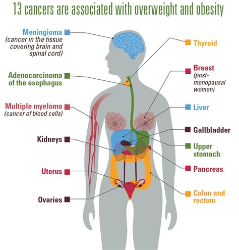 Cancer And Obesity Vitalsigns Cdc