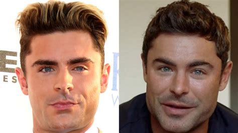Zac Efron Transformation Actor Revealed What Really Happened To His