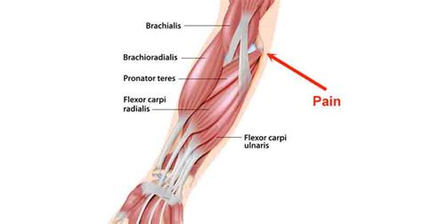 Brachioradialis Muscle Origin And Insertion