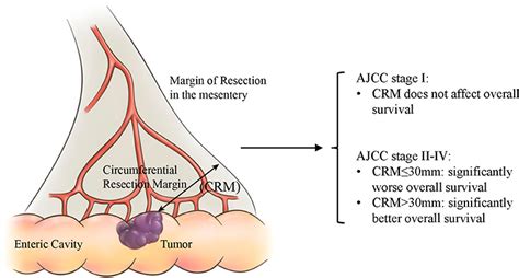 Frontiers The Circumferential Resection Margin Is A Prognostic Predictor In Colon Cancer