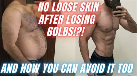 how to avoid loose skin after weight loss prevent excess skin after transformation youtube