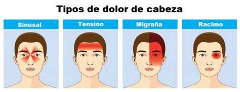 Tipos De Dolores De Cabeza Headache Symptoms Headache Types Sinus