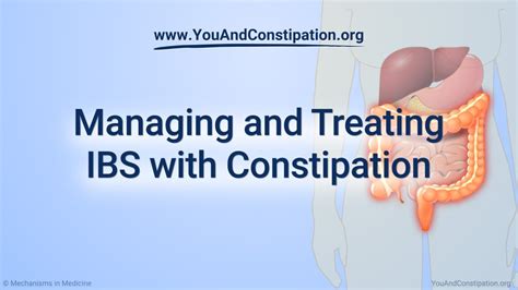 Managing And Treating Ibs C Youtube