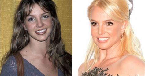 10 famous celebrities with plastic surgery celebrities with plastic surgery kulturaupice