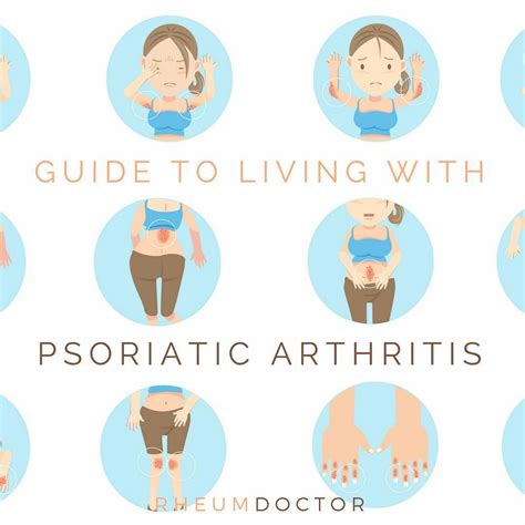 What Is Psoriatic Arthritis And How Is It Similar Or Dissimilar To Ra