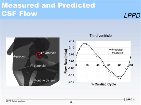 PPT Measurements And Computational Modeling Of Cerebrospinal Fluid Flow In Humans PowerPoint