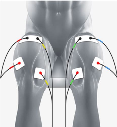 Neuromuscular Electrical Stimulation Nmes Following Knee Injurysurgery