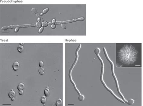3 Morphology Of Yeast Hyphae And Pseudo Hyphal Forms 63 Download