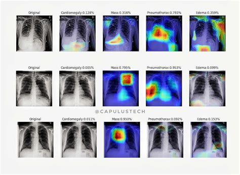 Ai Based Solution For Covid 19 Detection On Chest X Rays And Ct Scans