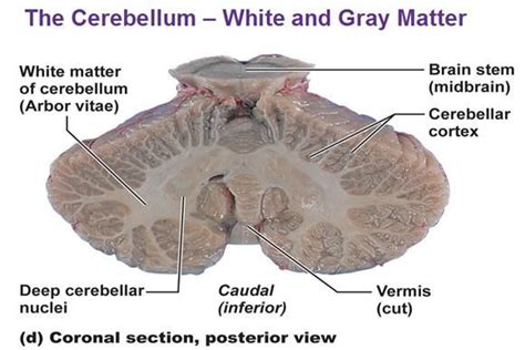 Coronal Section Cerebellum Nuclei And White Matter Cerebellum