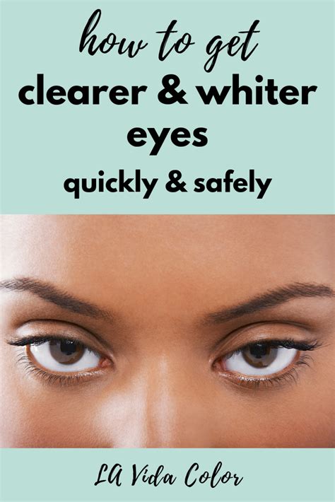 Get Clearer Whiter Eyes Lumify Eye Drops Review In 2020 Whiten Eyes