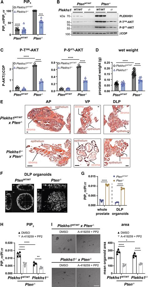 Plekhs1 Drives Pi3ks And Remodels Pathway Homeostasis In Pten Null