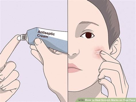 How To Heal Scratch Marks On Your Face Teachpedia
