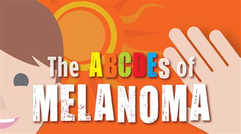 Abcdes Of Melanoma Infographic Sharp Healthcare