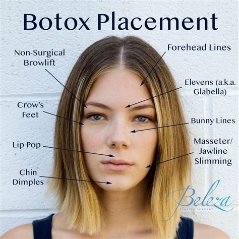 Botox Injections For Double Chin Telegraph