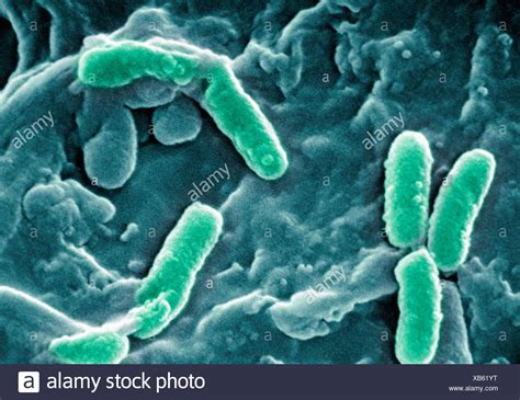 Bacterium Micrograph High Resolution Stock Photography And Images Alamy