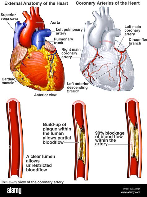 Heart Coronary Arteries With Potential Blockages Stock Photo 7710243