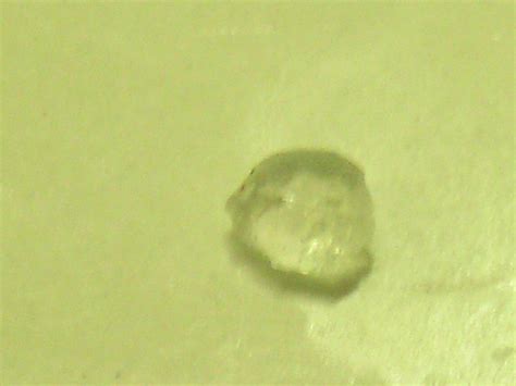 Morgellons Crystal G Pic Sept 2012 575 Flickr Photo Sharing