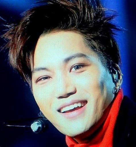 Netizens Claim Exos Kai Is Suffering Side Effects From Plastic Surgery