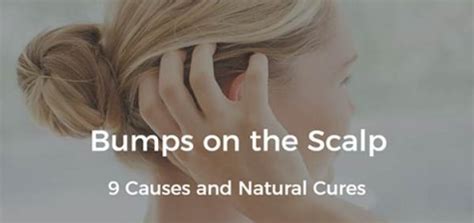 Bumps On Scalp 9 Causes And Natural Treatments