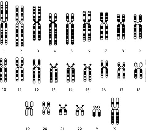 Diagrammatical Representation Of The Human Karyotype Of Haploid
