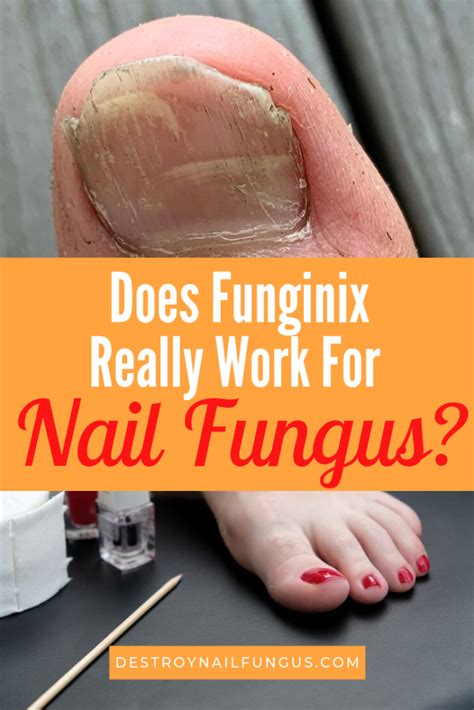 Funginix Review Does It Really Work For Nail Fungus