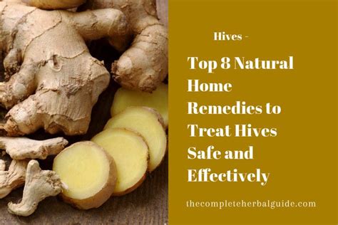 8 Ways To Get Rid Of Hives Hives Hives Remedies Chronic Hives