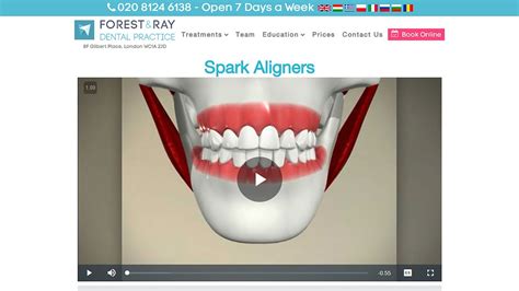 Spark Aligners London Forest And Ray Dentists Orthodontists Implant