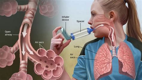 difference between bronchial asthma and asthma youtube