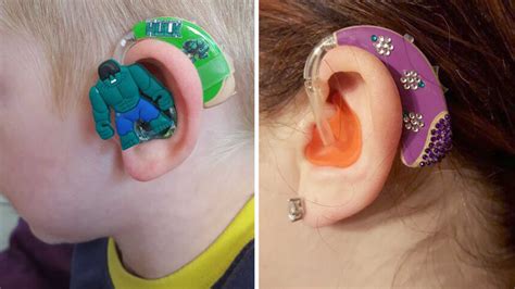 Designer Hearing Aids For Kids Thanks To This Supermom