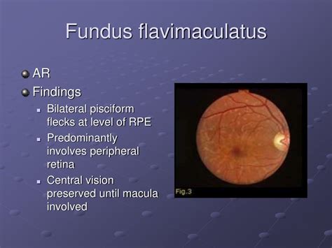 Ppt Vitreous And Retina Pediatric Ophthalmology Powerpoint