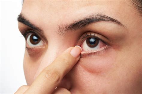 Eyelid Redness Causes Symptoms Inflamed Dry Itchy Swollen Red